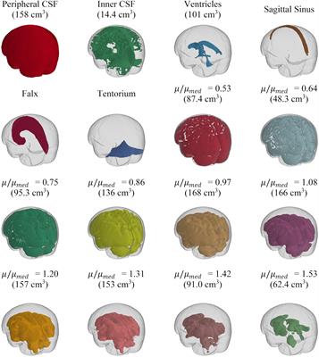 Calibration of a Heterogeneous Brain Model Using a Subject-Specific Inverse Finite Element Approach